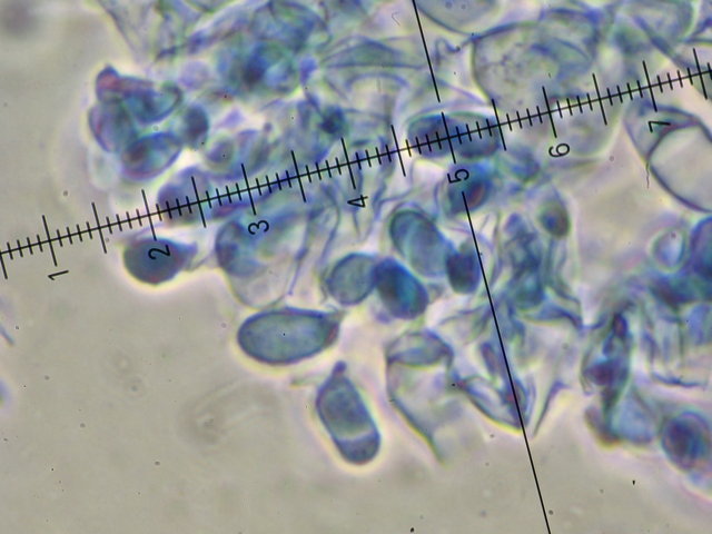 Botryobasidium con spore finemente verrucose